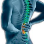 Reedley Physical Therapy, Physical Therapist, PT Near Me, Physiotherapy, Physical Therapy Clinic, Outpatient, Rehab, Rehabilitation, Arthritis, Spine, Back Pain, Sore Back, Lumbar, Low Back Pain